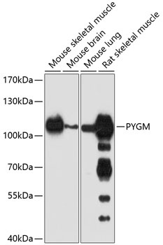 PYGM Antibody