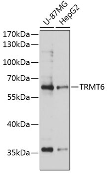 TRMT6 Antibody