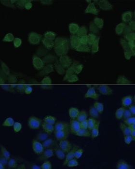 ZFYVE9 Antibody