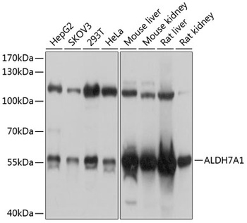 ALDH7A1 Antibody