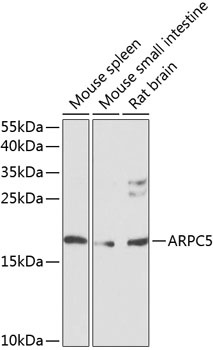 ARPC5 Antibody