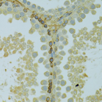 KCNJ1 Antibody