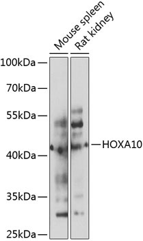 HOXA10 Antibody