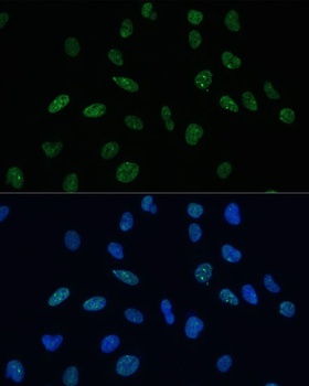 MKL1 Antibody