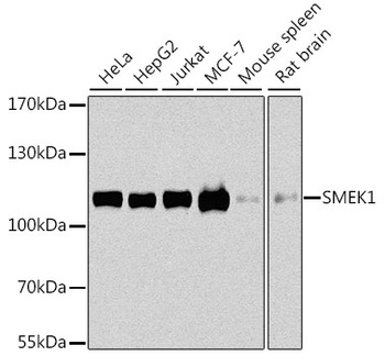 SMEK1 Antibody