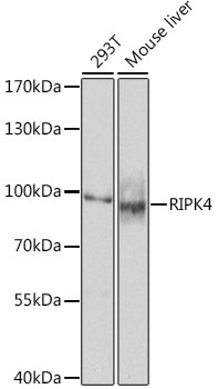 RIPK4 Antibody