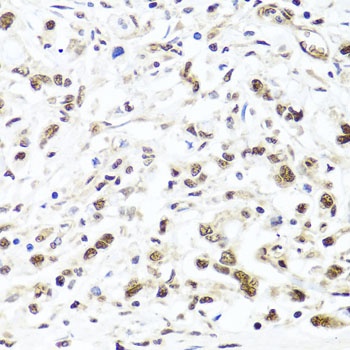 HIRA Antibody
