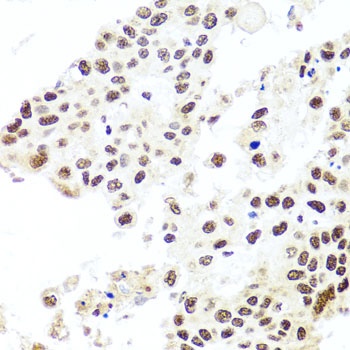 HIRA Antibody