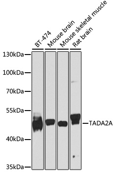 TADA2A Antibody