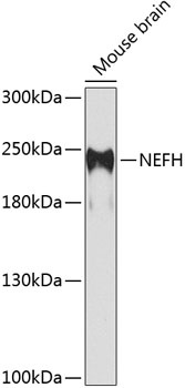 NEFH Antibody