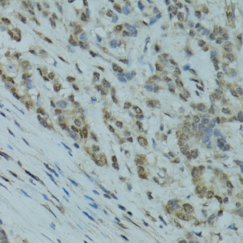 GABPA Antibody