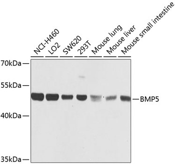 BMP5 Antibody