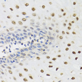 YTHDF3 Antibody