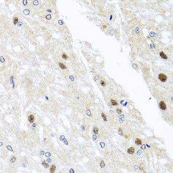 YTHDF3 Antibody