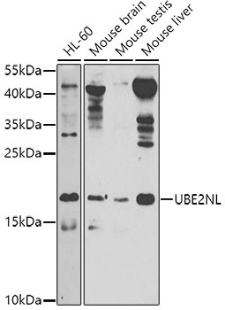 UBE2NL Antibody