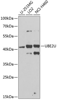 UBE2U Antibody