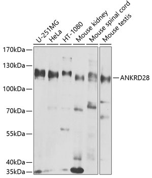 ANKRD28 Antibody