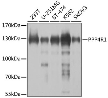 PPP4R1 Antibody