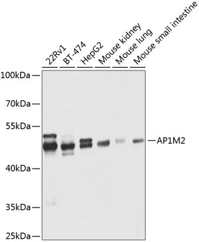 AP1M2 Antibody