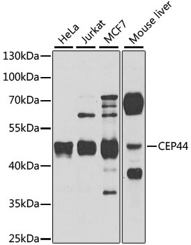 CEP44 Antibody