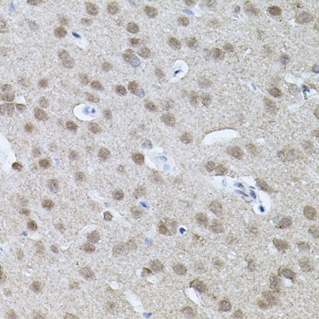 RNF166 Antibody