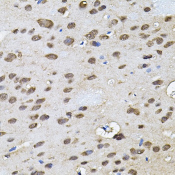 RNF166 Antibody