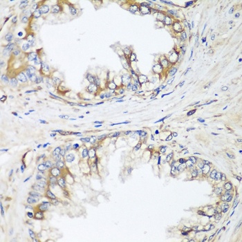 HPSE2 Antibody