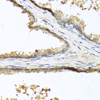 SOST Antibody