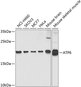 ATP6 Antibody