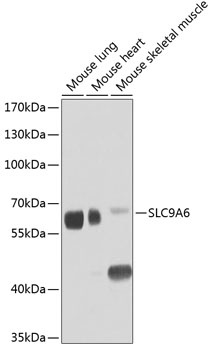 SLC9A6 Antibody