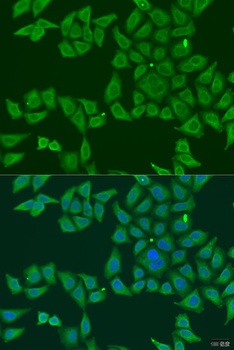 FKBP2 Antibody