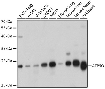 ATP5O Antibody