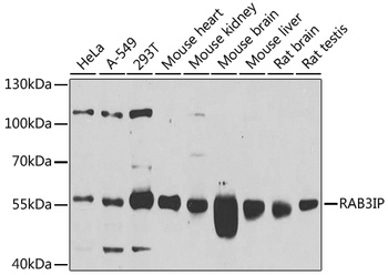 RAB3IP Antibody