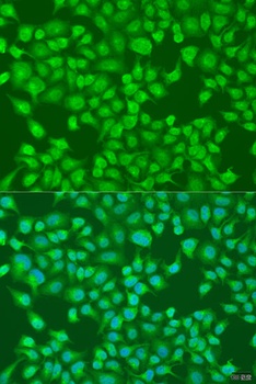 ACOX1 Antibody