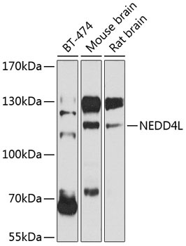 NEDD4L Antibody