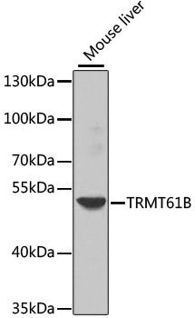 TRMT61B Antibody