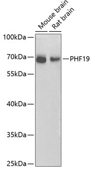 PHF19 Antibody