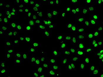 PHF19 Antibody