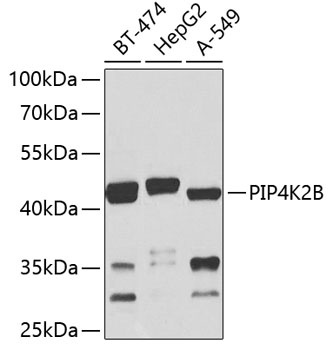 PIP4K2B Antibody