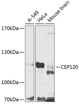 CEP120 Antibody