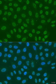 LSM2 Antibody