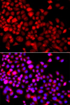 CALCOCO1 Antibody