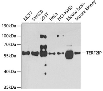 TERF2IP Antibody