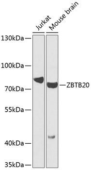 ZBTB20 Antibody