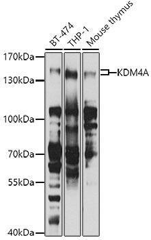 KDM4A Antibody