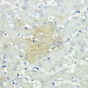 SOCS5 Antibody