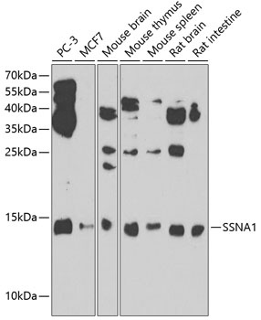 SSNA1 Antibody