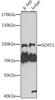 SORT1 Antibody