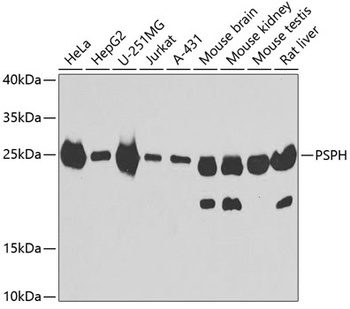 PSPH Antibody