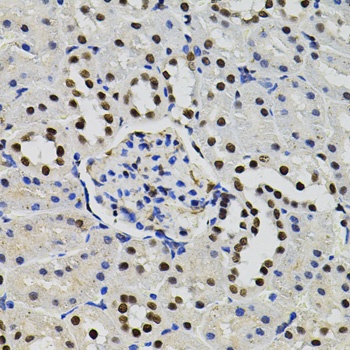 GTF2I Antibody